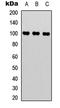 Mediator Complex Subunit 24 antibody, LS-C368414, Lifespan Biosciences, Western Blot image 