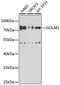 Golgi Membrane Protein 1 antibody, A7283, ABclonal Technology, Western Blot image 