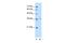 Tropomyosin 2 antibody, PA5-43143, Invitrogen Antibodies, Western Blot image 