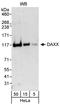 Death Domain Associated Protein antibody, A301-353A, Bethyl Labs, Western Blot image 