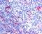 Neuroepithelial Cell Transforming 1 antibody, PA5-18217, Invitrogen Antibodies, Immunohistochemistry frozen image 