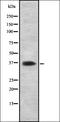 CD2 Cytoplasmic Tail Binding Protein 2 antibody, orb337440, Biorbyt, Western Blot image 