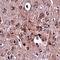 Protocadherin 18 antibody, orb75165, Biorbyt, Immunohistochemistry paraffin image 