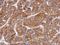 Matrix Metallopeptidase 8 antibody, GTX105428, GeneTex, Immunohistochemistry paraffin image 