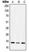 Integrin Subunit Alpha 5 antibody, LS-C352388, Lifespan Biosciences, Western Blot image 