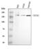 Transient Receptor Potential Cation Channel Subfamily M Member 2 antibody, A01013-1, Boster Biological Technology, Western Blot image 