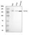 Transient receptor potential cation channel subfamily M member 2 antibody, A01013-1, Boster Biological Technology, Western Blot image 