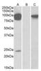Transient Receptor Potential Cation Channel Subfamily V Member 3 antibody, orb19932, Biorbyt, Western Blot image 