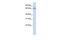 Calcium Voltage-Gated Channel Auxiliary Subunit Beta 2 antibody, GTX47538, GeneTex, Western Blot image 