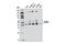Sphingosine Kinase 1 antibody, 12071S, Cell Signaling Technology, Western Blot image 