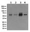 NADPH Oxidase 4 antibody, ab133303, Abcam, Western Blot image 