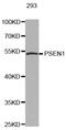 Presenilin 1 antibody, STJ25166, St John