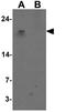 WAP Four-Disulfide Core Domain 2 antibody, GTX17207, GeneTex, Western Blot image 