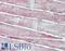 Superoxide Dismutase 2 antibody, LS-B9357, Lifespan Biosciences, Immunohistochemistry frozen image 