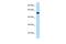 Protein Zfp874b antibody, PA5-69774, Invitrogen Antibodies, Western Blot image 