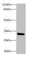 Eukaryotic Translation Elongation Factor 1 Delta antibody, LS-B12287, Lifespan Biosciences, Western Blot image 