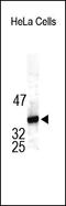 Nucleophosmin 1 antibody, 252120, Abbiotec, Western Blot image 