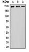 Interferon Regulatory Factor 5 antibody, orb234883, Biorbyt, Western Blot image 