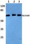 Solute Carrier Family 6 Member 8 antibody, A02579, Boster Biological Technology, Western Blot image 