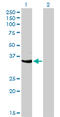 Cyclin Dependent Kinase 3 antibody, LS-C104915, Lifespan Biosciences, Western Blot image 