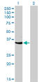 Cyclin-dependent kinase 3 antibody, LS-C104915, Lifespan Biosciences, Western Blot image 