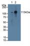 Signal Transducer And Activator Of Transcription 2 antibody, MBS2026299, MyBioSource, Western Blot image 