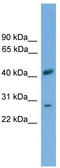 Solute Carrier Family 25 Member 37 antibody, TA333775, Origene, Western Blot image 