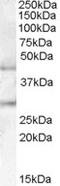 UDP-GlcNAc:BetaGal Beta-1,3-N-Acetylglucosaminyltransferase 2 antibody, EB08038, Everest Biotech, Western Blot image 