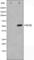 Serum/Glucocorticoid Regulated Kinase 1 antibody, abx012085, Abbexa, Western Blot image 