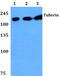 TSC Complex Subunit 2 antibody, AP06590PU-N, Origene, Western Blot image 
