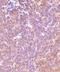 P21 (RAC1) Activated Kinase 2 antibody, NBP1-76720, Novus Biologicals, Immunohistochemistry frozen image 