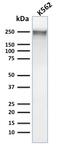 Spectrin Alpha, Erythrocytic 1 antibody, GTX18000, GeneTex, Western Blot image 