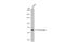 Interleukin 6 Receptor antibody, GTX134862, GeneTex, Western Blot image 