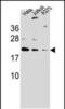 ADP Ribosylation Factor Like GTPase 6 Interacting Protein 6 antibody, PA5-48553, Invitrogen Antibodies, Western Blot image 