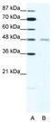 Cholinergic Receptor Nicotinic Delta Subunit antibody, TA330430, Origene, Western Blot image 