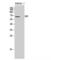 NADP-dependent malic enzyme, mitochondrial antibody, LS-C384469, Lifespan Biosciences, Western Blot image 