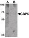 Guanylate Binding Protein 5 antibody, PA5-34541, Invitrogen Antibodies, Western Blot image 