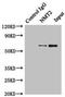N-Myristoyltransferase 2 antibody, LS-C676171, Lifespan Biosciences, Immunoprecipitation image 