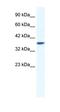 Potassium Two Pore Domain Channel Subfamily K Member 3 antibody, orb329807, Biorbyt, Western Blot image 