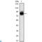 Kelch Like Family Member 21 antibody, LS-C812675, Lifespan Biosciences, Western Blot image 