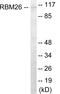 RNA Binding Motif Protein 26 antibody, EKC1851, Boster Biological Technology, Western Blot image 