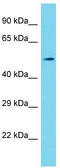 SHQ1, H/ACA Ribonucleoprotein Assembly Factor antibody, TA344926, Origene, Western Blot image 