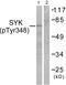 Spleen Associated Tyrosine Kinase antibody, PA5-38094, Invitrogen Antibodies, Western Blot image 