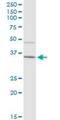 Immunoglobulin Heavy Constant Alpha 2 (A2m Marker) antibody, H00003494-B01P, Novus Biologicals, Western Blot image 