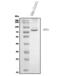 Ectonucleoside Triphosphate Diphosphohydrolase 1 antibody, A03196-3, Boster Biological Technology, Western Blot image 