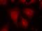 Histone Deacetylase 8 antibody, GTX50189, GeneTex, Immunofluorescence image 