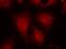Histone Deacetylase 8 antibody, GTX50189, GeneTex, Immunofluorescence image 