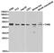 Thyroid Hormone Receptor Beta antibody, TA327090, Origene, Western Blot image 