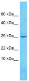 TLC Domain Containing 5 antibody, TA330782, Origene, Western Blot image 