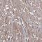 Isocitrate Dehydrogenase (NAD(+)) 3 Beta antibody, NBP2-14114, Novus Biologicals, Immunohistochemistry frozen image 